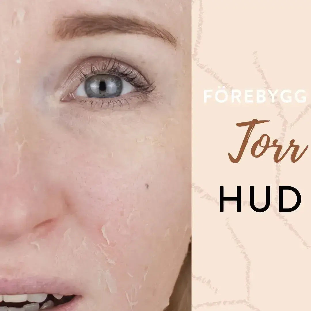 Förebygger och behandlar torr hud